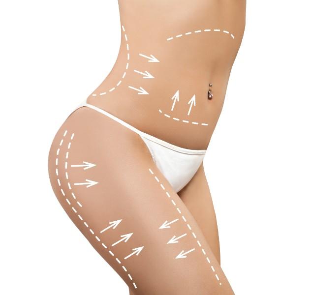 chirurgie esthétique du corps