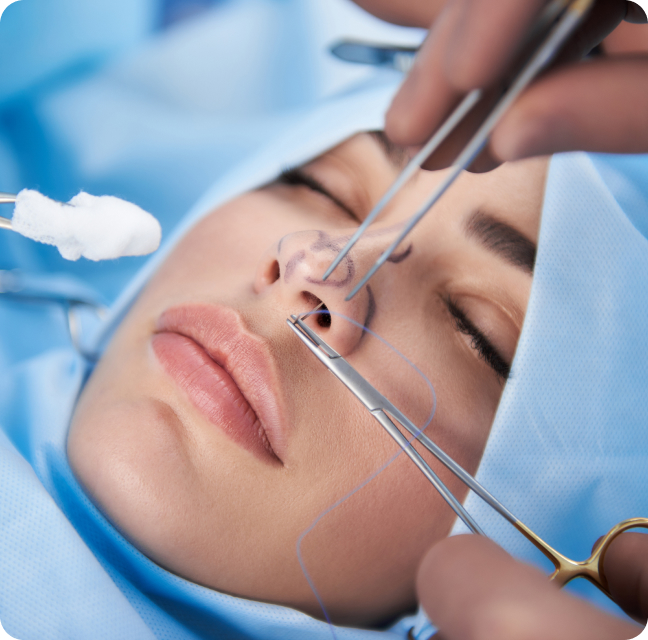 Chirurgie esthétique