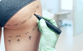 Chirurgie corps